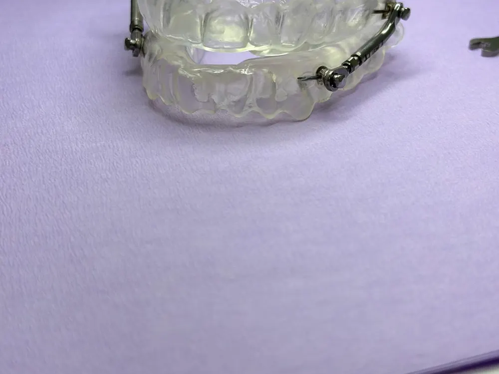 Férulas para la apnea del sueño en Reinadent, Estepa