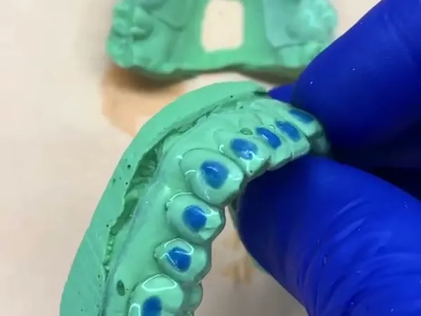 Modelos de los dientes
